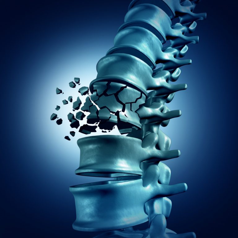 a picture of spine